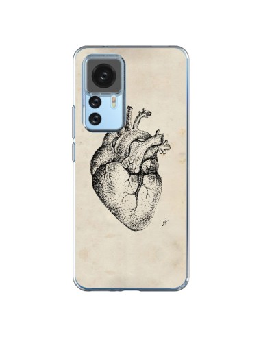 Coque Xiaomi 12T/12T Pro Coeur Vintage - Tipsy Eyes