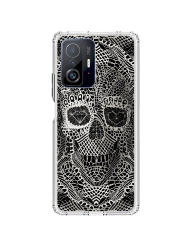 Coque Xiaomi 11T / 11T Pro Skull Lace Tête de Mort - Ali Gulec