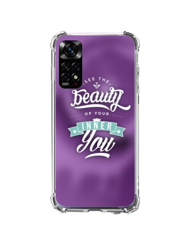 Coque Xiaomi Redmi Note 11 / 11S Beauty Violet - Javier Martinez